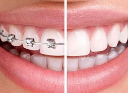 dental society Invisalign