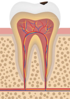 early tooth decay