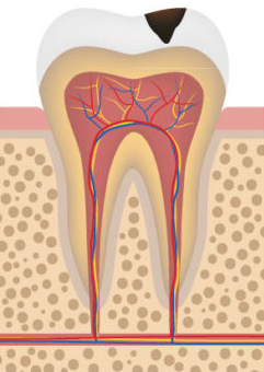 stage 2 decay