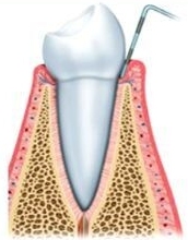 healthy gums dental society