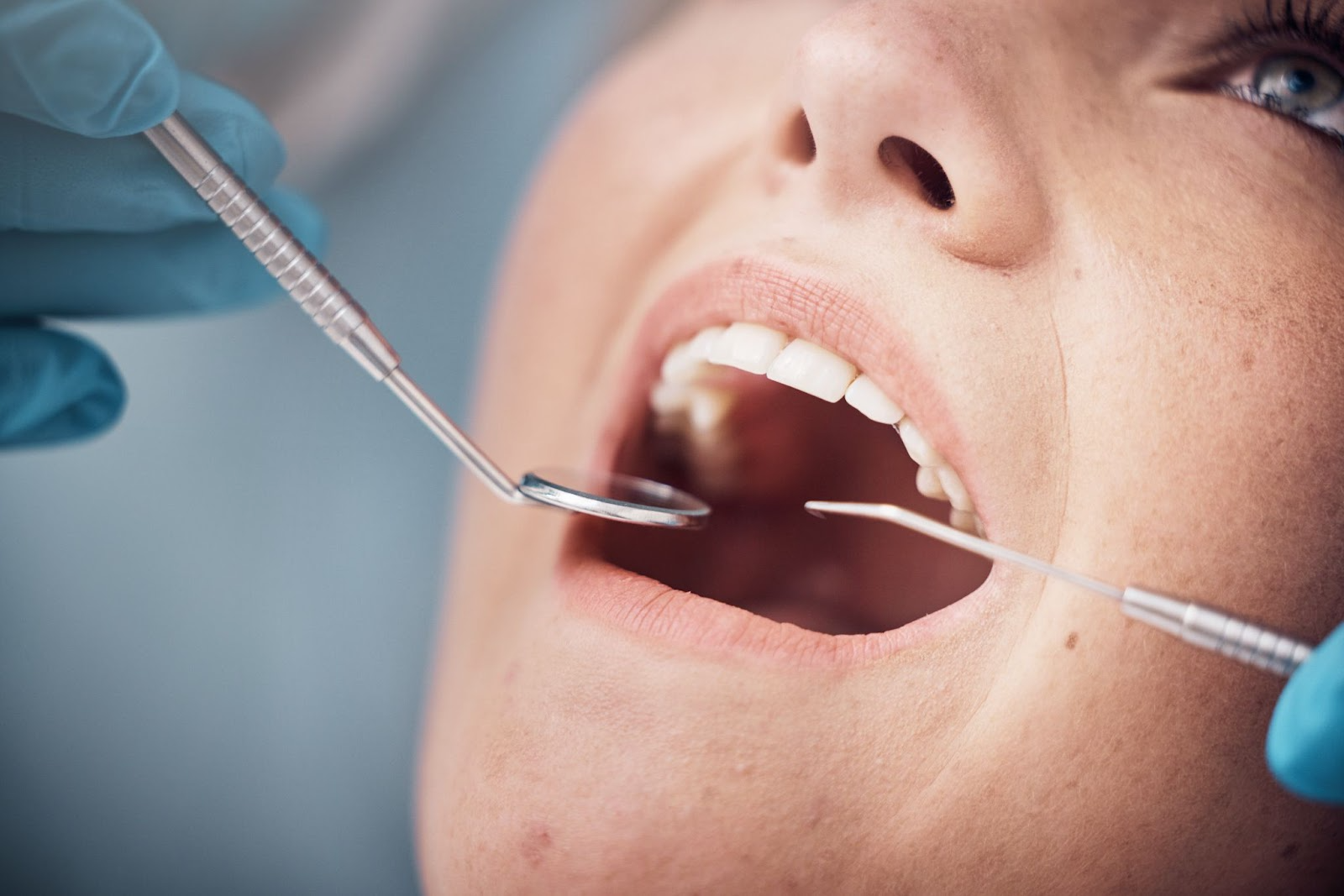 Featured image for “Periodontal Gum Disease Treatment”